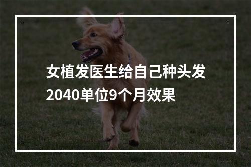 女植发医生给自己种头发2040单位9个月效果