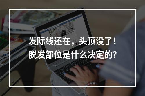 发际线还在，头顶没了！脱发部位是什么决定的？