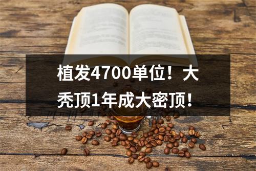 植发4700单位！大秃顶1年成大密顶！