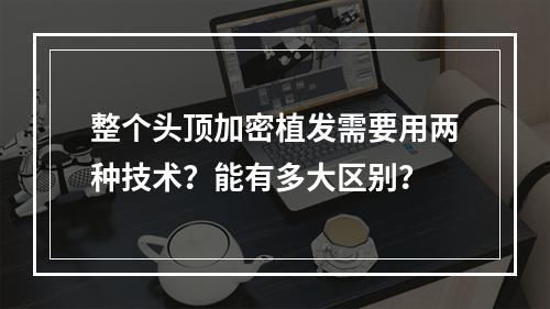 整个头顶加密植发需要用两种技术？能有多大区别？