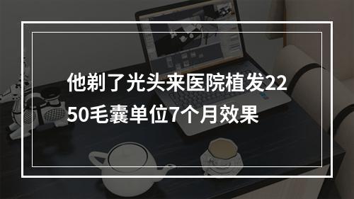 他剃了光头来医院植发2250毛囊单位7个月效果