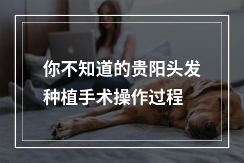 你不知道的贵阳头发种植手术操作过程