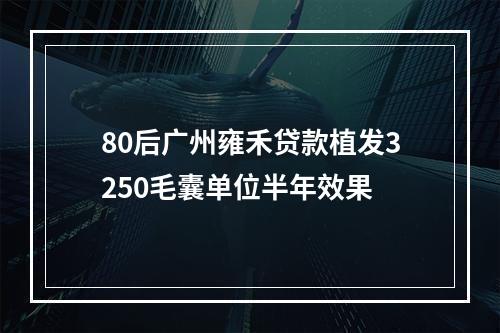 80后广州雍禾贷款植发3250毛囊单位半年效果