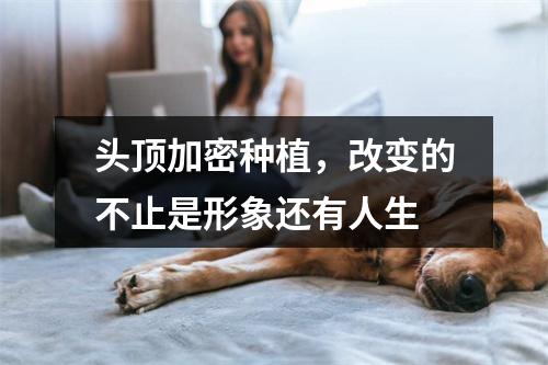 头顶加密种植，改变的不止是形象还有人生