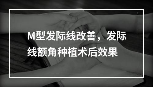 M型发际线改善，发际线额角种植术后效果