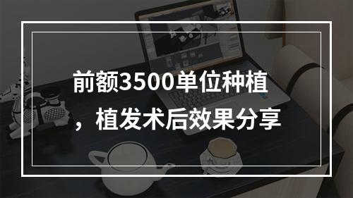 前额3500单位种植，植发术后效果分享