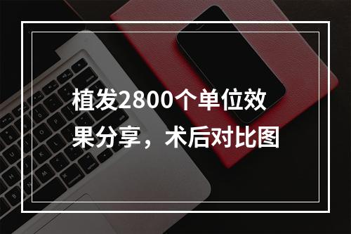 植发2800个单位效果分享，术后对比图