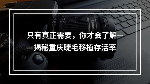 只有真正需要，你才会了解——揭秘重庆睫毛移植存活率