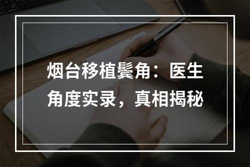 烟台移植鬓角：医生角度实录，真相揭秘