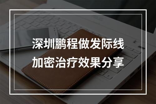 深圳鹏程做发际线加密治疗效果分享