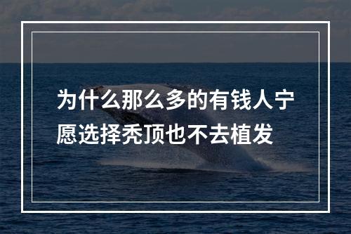 为什么那么多的有钱人宁愿选择秃顶也不去植发