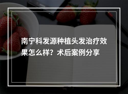 南宁科发源种植头发治疗效果怎么样？术后案例分享