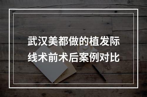 武汉美都做的植发际线术前术后案例对比