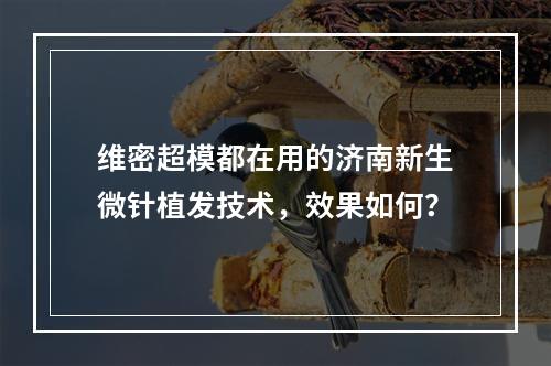 维密超模都在用的济南新生微针植发技术，效果如何？