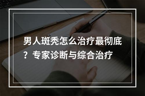 男人斑秃怎么治疗最彻底？专家诊断与综合治疗