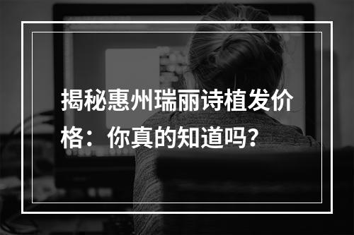 揭秘惠州瑞丽诗植发价格：你真的知道吗？