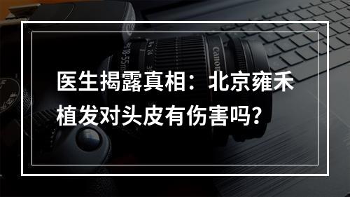 医生揭露真相：北京雍禾植发对头皮有伤害吗？