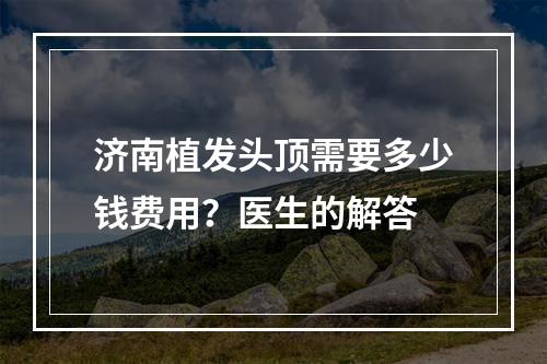 济南植发头顶需要多少钱费用？医生的解答