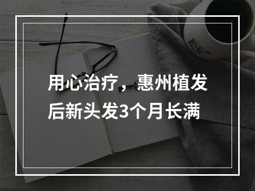 用心治疗，惠州植发后新头发3个月长满