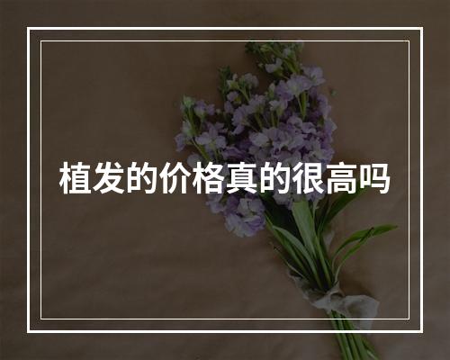 植发的价格真的很高吗