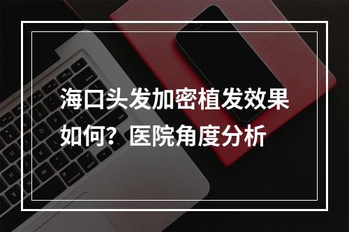 海口头发加密植发效果如何？医院角度分析