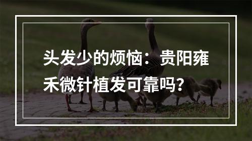 头发少的烦恼：贵阳雍禾微针植发可靠吗？