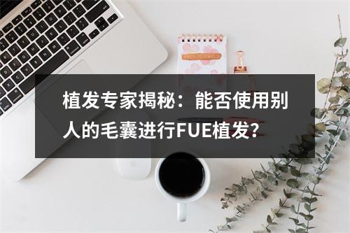 植发专家揭秘：能否使用别人的毛囊进行FUE植发？