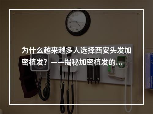 为什么越来越多人选择西安头发加密植发？——揭秘加密植发的好处