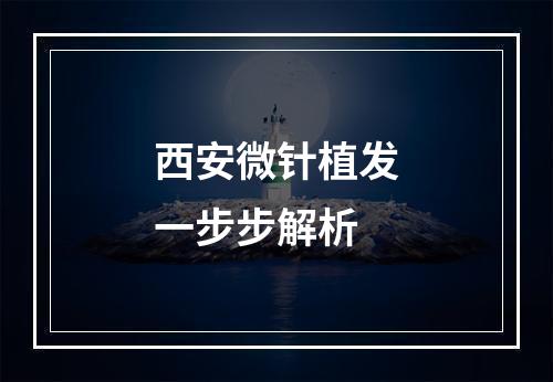 西安微针植发一步步解析