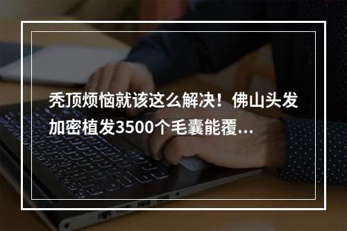 秃顶烦恼就该这么解决！佛山头发加密植发3500个毛囊能覆盖多大面积？