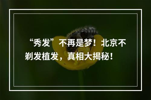 “秀发”不再是梦！北京不剃发植发，真相大揭秘！