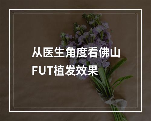 从医生角度看佛山FUT植发效果