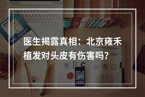 医生揭露真相：北京雍禾植发对头皮有伤害吗？