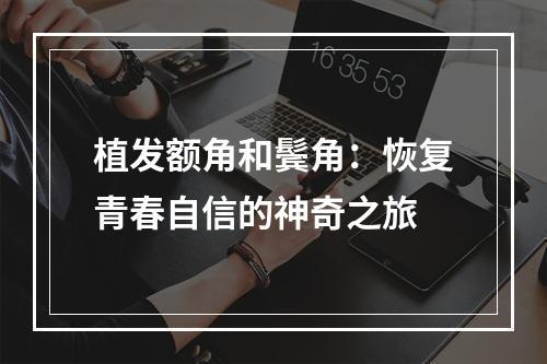 植发额角和鬓角：恢复青春自信的神奇之旅