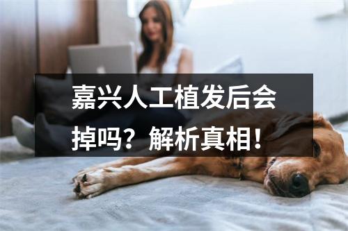 嘉兴人工植发后会掉吗？解析真相！