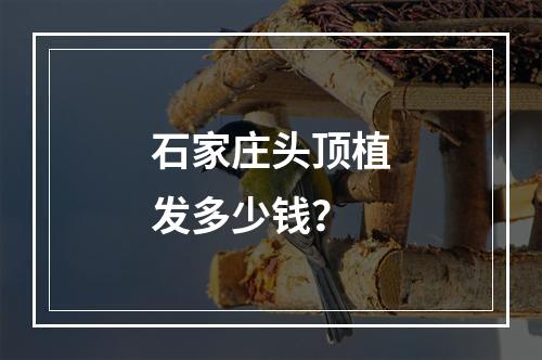 石家庄头顶植发多少钱？