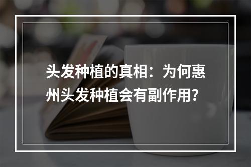 头发种植的真相：为何惠州头发种植会有副作用？