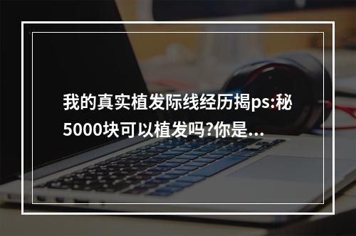 我的真实植发际线经历揭ps:秘5000块可以植发吗?你是不是被坑了