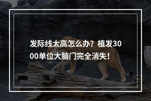 发际线太高怎么办？植发3000单位大脑门完全消失！