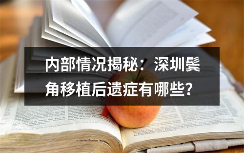 内部情况揭秘：深圳鬓角移植后遗症有哪些？