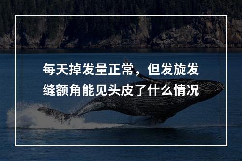 每天掉发量正常，但发旋发缝额角能见头皮了什么情况