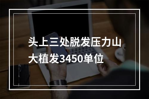 头上三处脱发压力山大植发3450单位