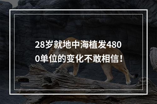 28岁就地中海植发4800单位的变化不敢相信！