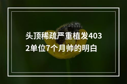 头顶稀疏严重植发4032单位7个月帅的明白