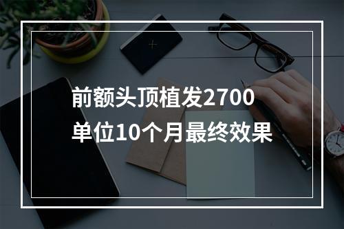 前额头顶植发2700单位10个月最终效果