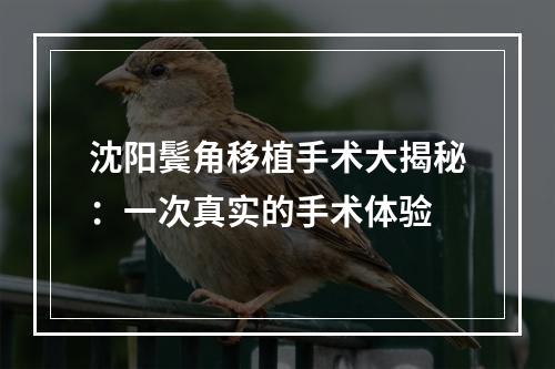 沈阳鬓角移植手术大揭秘：一次真实的手术体验