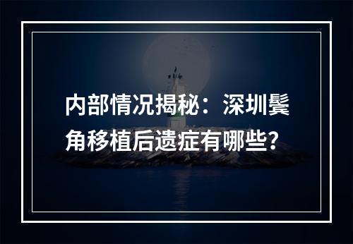 内部情况揭秘：深圳鬓角移植后遗症有哪些？