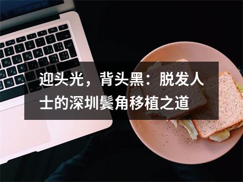 迎头光，背头黑：脱发人士的深圳鬓角移植之道