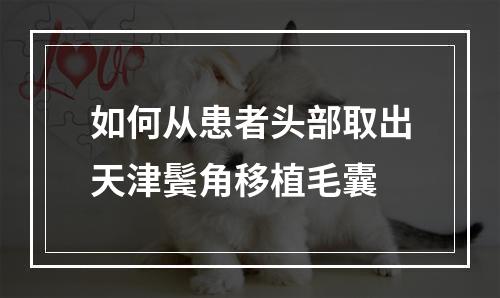 如何从患者头部取出天津鬓角移植毛囊