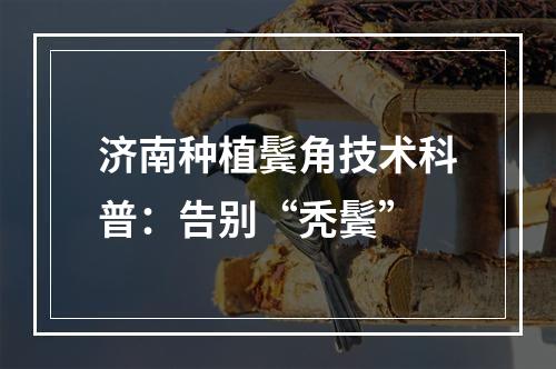 济南种植鬓角技术科普：告别“秃鬓”